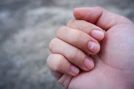 Kondisi yang paling umum menyebabkan kuku hitam adalah trauma repetitif. Tanda Putih Di Kuku Bukan Pertanda Ada Yang Rindu Lalu Apa Halaman All Kompas Com