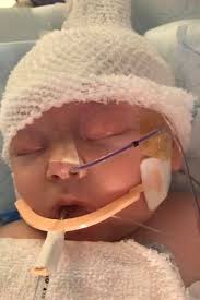 Newborn suffers skull fractures after being hit by a ball