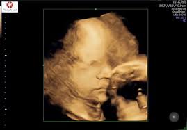 Aaron Richey|Girl Dad (@therealarichey)