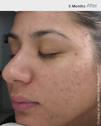 jan marini skin care