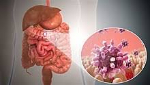 Gastroenteritis Wikipedia