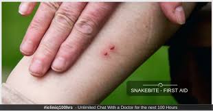 Image result for Snake Bite