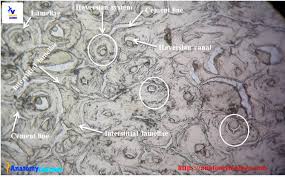 The osteon consists of a central canal called the osteogenic (haversian) canal, which is surrounded by concentric rings (lamellae) of the matrix. Compact Bone Histology Circumferential Interstitial And Haversian System Anatomylearner The Place To Learn Veterinary Anatomy Online