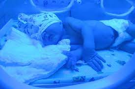 We did not find results for: A Slight Increase In Pediatric Cancer Risk Seen With Infant Phototherapy Uc San Francisco