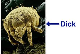 Image result for Dust mite