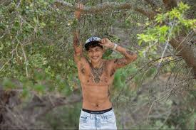 Image result for Mastectomy