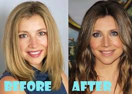 Sarah chalke is a canadian actress best known for playing dr. Sarah Chalke Plastic Surgery Before And After Nose Job Nose Job Plastic Surgery Celebrities Before And After