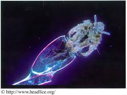 Eggs hatch in six to nine days. Lousology 101 Understand Louse And Nits Headlice Org