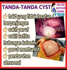 Kedua tanda tersebut adalah tanda kiamat sugra (tanda kiamat kecil) dan tanda kiamat kubra (tanda kiamat besar). Tanda Tanda Cyst Atau Fibroid Ssb Terlaris Meru Facebook