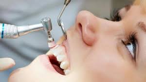Maybe you would like to learn more about one of these? Baru Tahu Ternyata Ini Obat Sakit Gigi Paling Manjur Tribun Jabar