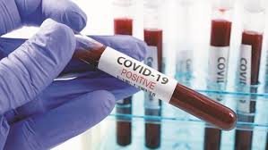Covid-19: Are we testing enough? Here's how India fares versus others | Health News - Business Standard