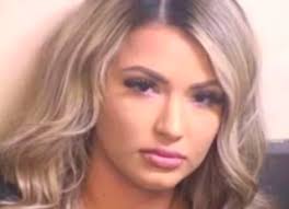 Le manifestazioni dell'alopecia androgenetica risultano diverse nei due sessi. Guardia Carceraria Si Fa Un Buco Nei Pantaloni Per Fare Sesso Col Detenuto