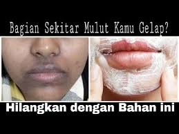Salah satu cara menghilangkan bibir hitam dalam waktu yang singkat adalah mengaplikasikan lipstik berwarna merah atau pink ke bibir. Menghilangkan Lingkaran Hitam Di Sekitar Mulut How To Remove Hyper Pigmentation Around Your Mouth Youtube