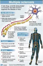 In the most common type (known as relapsing remitting ms), symptoms come and go. Mcdonald Criteria For Diagnosing Multiple Sclerosis Revised