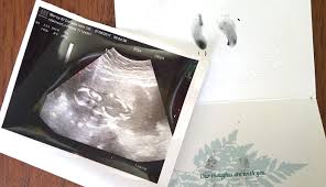 What can cause missed miscarriage. My Second Missed Miscarriage The Lovely Geek