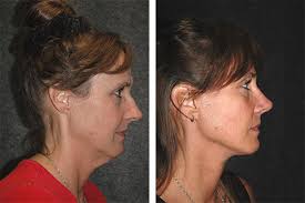 Dr. Andrew Jacono: Helping Patients Look Their “Natural Best”!