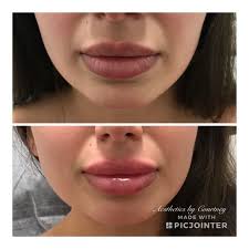 195 vind-ik-leuks, 9 opmerkingen