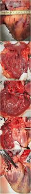 Most forensic pathologists are familiar with wounds and other . Double Suicidal Gunshot Wounds To The Heart Springerlink