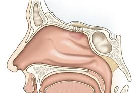 Browse the user profile and get inspired. Diagnostik Nase Und Nasennebenhohlen Hno Regensburg