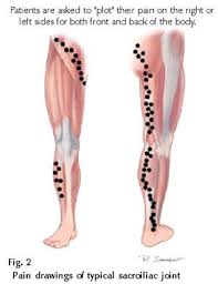 Pin On Health Joints