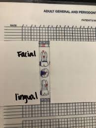 dental charting dh 104 flashcards quizlet