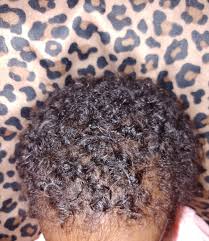 In tandem with the dry scalp tip above, after. African American Baby S Hair September 2017 Babies Forums What To Expect