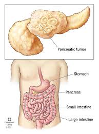 Image result for pancreas)