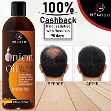 For some, hair loss can come out of nowhere, leaving you with your locks clumped in. What Is The Simple Way To Stop Hair Loss Naturally Quora
