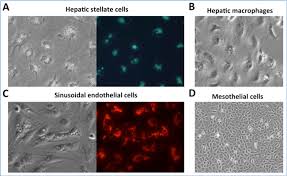 Frontiers in bioscience scholar 10 65100 january 1 2018. Integrative Liver Cell Research Center For Alpd And Cirrhosis Center