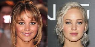 According to an expert at baylor college of medicine, scalp injuries or chemical burns from hair dye are not uncommon, especially for those who have sensitive skin. 7 Gross Things That Sometimes Happen When You Bleach Your Hair