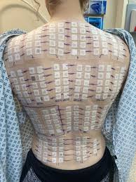 Image result for Patch Testing