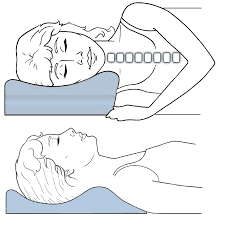 Stiffness, stress, and poor sleep can trigger both migraine or tension headaches. Pillows For Neck Pain Headaches