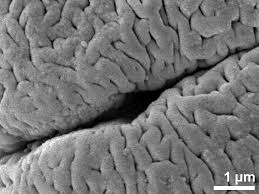 Image result for Astropanax goetzenii