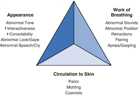 Image result for Pediatric Assessment Triangle