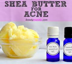 Homemade Remedy Using Shea Butter For Acne Beautymunsta Free Natural Beauty Hacks And More Shea Butter Recipes Homemade Wrinkle Cream Shea Butter Face