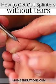 If you have a splinter splinters in difficult locations are tough to take out, and are more likely to become infected if not removed properly. Pin On Health And Fitness Mom Generations