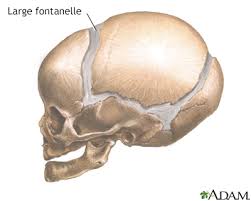 Fontanelles Enlarged Information Mount Sinai New York