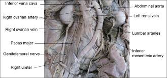 Arched Abdominal Aorta And Altered Course Of Right Ovarian Vessels In A Female Cadaver Clinical Significance And Embryological Explanation Kalthur Sg Siddaraju K S D Souza As Med J Dy Patil Univ