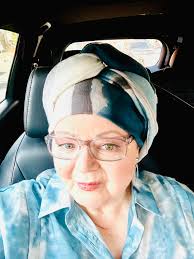 Traumatizing 😞 hairloss is real … sleeved Jan 9 2023