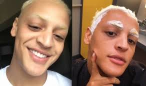 Vale ressaltar que apesar de, na imagem do antes, pabllo estar sem maquiagem e, no depois, estar toda produzida, a diferença no formato no nariz é bem perceptível e podemos dizer que a cirurgia foi um sucesso. Pabllo Vittar Mostra Resultado De Cirurgia No Nariz Veja Antes E Depois