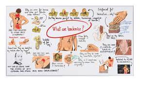 63 Questions With Answers In Low Back Pain Science Topic