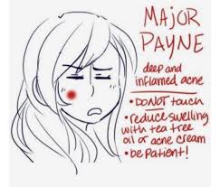 The Acne Chart By Kirandeep Kour Musely