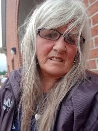 What are the issues for not having surgery?! My doctor hasn't shared much  information..He wanted to try injections first. It lasted a month or less.  Debating contacting him again. Here's what my