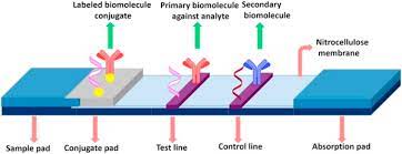 A swab is taken from the back of the nose or throat, mixed with an extraction fluid, and a drop of this mixture is placed. Lateral Flow Assays Principles Designs And Labels Sciencedirect