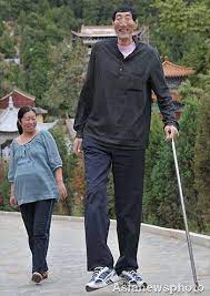 Gigantism is a rare disease that is the subject of a lot of research and speculation. 89 Acromegaly Gigantism Ideas Human Oddities Giant People Nephilim Giants