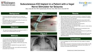 It indicates what the arguer is trying to prove to his audience. D Po03 049 Subcutaneous Icd Implant In A Patient With A Vagal Nerve Stimulator For Seizures Id 293 Heart Rhythm Society 2020 41st Annual Scientific Sessions