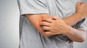 Selain wanginya yang menyegarkan, sari lemon memiliki selalu amati perubahan kulit yang terjadi ketika menggunakan deodorant, anti perspirant, dan juga parfum. 5 Bahan Alami Ini Bisa Jadi Obat Gatal Pada Kulit