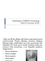 Check spelling or type a new query. Soal Radiologi Ukmppd