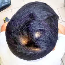 Eliminate cowlicks, swirls and other erratic growth patterns. Baey Yam Keng é©¬ç‚Žåº† On Twitter Old Wives Tale More Hair Swirls The Naughtier The Person But Teacher Said This Boy Is Very Well Behaved