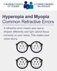 Image result for Refractive Error